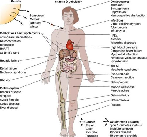 Phong benh Alzheimer / Bs Mike Roizen & Bs Mehmet OZ 